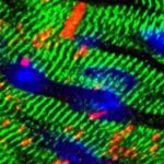 Study: Discovery may aid doctors in diagnosing at-risk patients before symptoms appear — (Details)