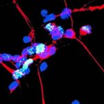 Study: Road to cell death more clearly identified for Parkinson’s disease — (Details)