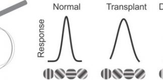 Research: Evidence of restored vision in rats following cell transplant —