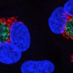 Study: The bacterium remodels human cells for its own nefarious purposes — (Details)