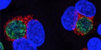 Study: The bacterium remodels human cells for its own nefarious purposes — (Details)