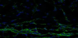 Study: Skin ages when the main cells in the dermis lose their identity and function — (Details)