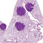 Study: Scientists find how the enzyme AMPK, largely thought to suppress cancer, actually helps some tumors survive — (Details)