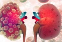 Research: Healing kidneys with nanotechnology —