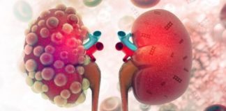 Research: Healing kidneys with nanotechnology —