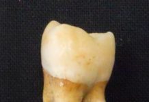 Research: New method to find biological sex from a single tooth —