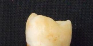 Research: New method to find biological sex from a single tooth —