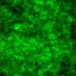 Study: Technique enables direct imaging of neural tissue; could lead to earlier detection of diseases affecting eye tissue — (Details)