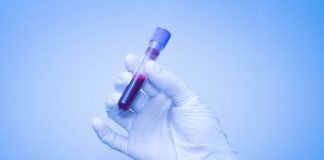 Study: A new approach to detecting cancer earlier from blood tests — (Details)