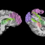 Study: MRI study reveals that repeated blows to the head cause microscopic changes in young players’ brains — (Details)