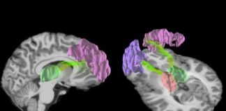 Study: MRI study reveals that repeated blows to the head cause microscopic changes in young players’ brains — (Details)