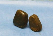 Research: Scientists explain how wombats drop cubed feces —