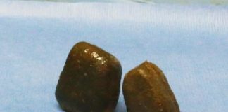 Research: Scientists explain how wombats drop cubed feces —