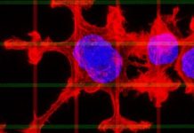 Research: New study sheds light on how cancer cells change their movements —