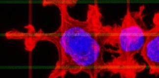 Research: New study sheds light on how cancer cells change their movements —