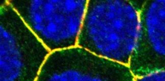 Study: The infectious bacterium diverts to its advantage a structure set up by human cells, in order to destroy them and invade the organism — (Details)