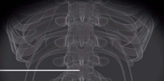 Study: Pulsed radiofrequency relieves acute back pain and sciatica — (Details)