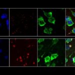Study: Snippets of RNA that accumulate in brain cells could interfere with normal function — (Details)