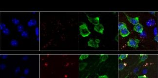Study: Snippets of RNA that accumulate in brain cells could interfere with normal function — (Details)