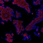 Study: Mapping of cells in the early human placenta may shed light on problem pregnancies — (Details)