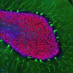 Study: New method for studying gene expression could improve understanding of brain disease — (Details)