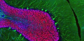 Study: New method for studying gene expression could improve understanding of brain disease — (Details)