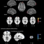 Study: Online gaming addiction in men affects brain’s impulse control — (Details)