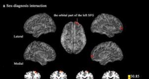 Study: Online gaming addiction in men affects brain’s impulse control — (Details)