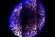 Research: Injectable material made of nanoscale particles can deliver arthritis drugs throughout cartilage —