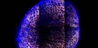 Research: Injectable material made of nanoscale particles can deliver arthritis drugs throughout cartilage —