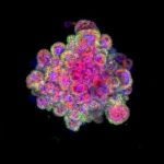 Study: ‘Mini-placentas’ could provide a model for early pregnancy — (Details)