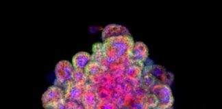 Study: ‘Mini-placentas’ could provide a model for early pregnancy — (Details)