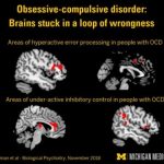 Study: Brain study shows roots of OCD — (Details)