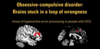 Study: Brain study shows roots of OCD — (Details)