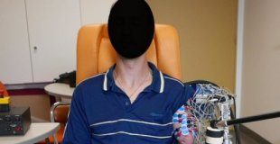 Study: A prosthetic arm that decodes phantom limb movements — (Details)