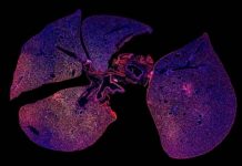 Tech: The results could also indicate whether antibiotics have successfully treated the infection — (Report)