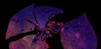 Tech: The results could also indicate whether antibiotics have successfully treated the infection — (Report)