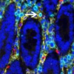 Study: Some blood cells have a surprising source: Your gut — (Details)