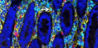 Study: Some blood cells have a surprising source: Your gut — (Details)