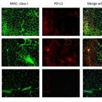 Study: Immune checkpoints could be key to treating autoimmune disease myasthenia gravis — (Details)