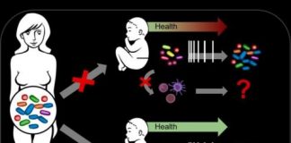 Study: Altered microbiome after caesarean section impacts baby’s immune system — (Details)