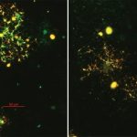 Study: In vitro cell culture findings could lead to novel interventions for Schizophrenia — (Details)