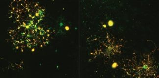 Study: In vitro cell culture findings could lead to novel interventions for Schizophrenia — (Details)