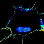 Study: Sensors developed to detect and measure cancer’s ability to spread — (Details)