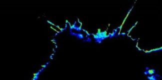 Study: Sensors developed to detect and measure cancer’s ability to spread — (Details)