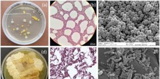 Research: Bacterial spores may be able to halt degradation by outcompeting other microbes —