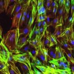 Study: Scientists cut main heart disease risk locus out of DNA by genome editing — (Details)