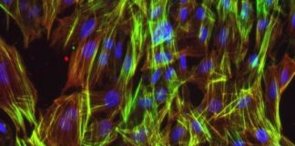 Study: Scientists cut main heart disease risk locus out of DNA by genome editing — (Details)