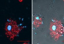 Research: Silicosis is on the rise, but is there a therapeutic target? —