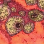 Study: Study findings can immediately be applied to human patients with the disease — (Details)